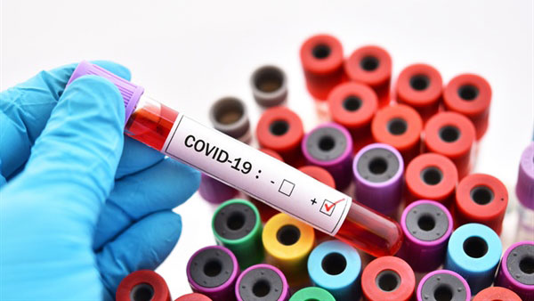 Ten new positive COVID cases reported in Floyd County over the last week